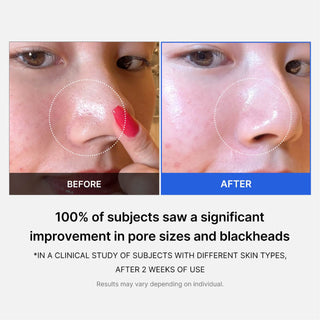 Zero Pore Serum 2.0 - Medicube