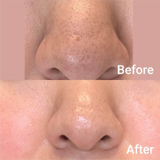 Zero Pore Serum 2.0 - Medicube