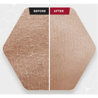 Zombie Beauty Bloody Peel - SKIN1004