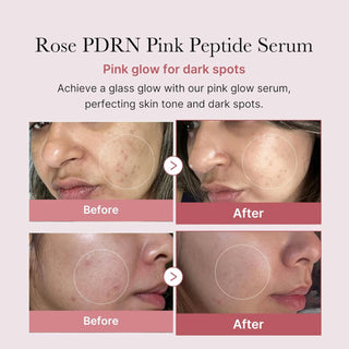 PDRN Pink Peptide Serum - Medicube