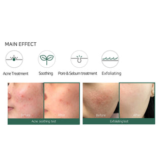 AHA.BHA.PHA 30 Days Miracle Acne Clear Foam - SOME BY MI