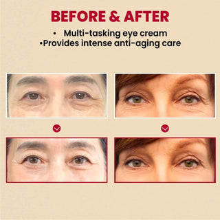 SEOUL 1988 Eye Cream – Retinal Liposome 4% + Fermented Bean – K-SECRET